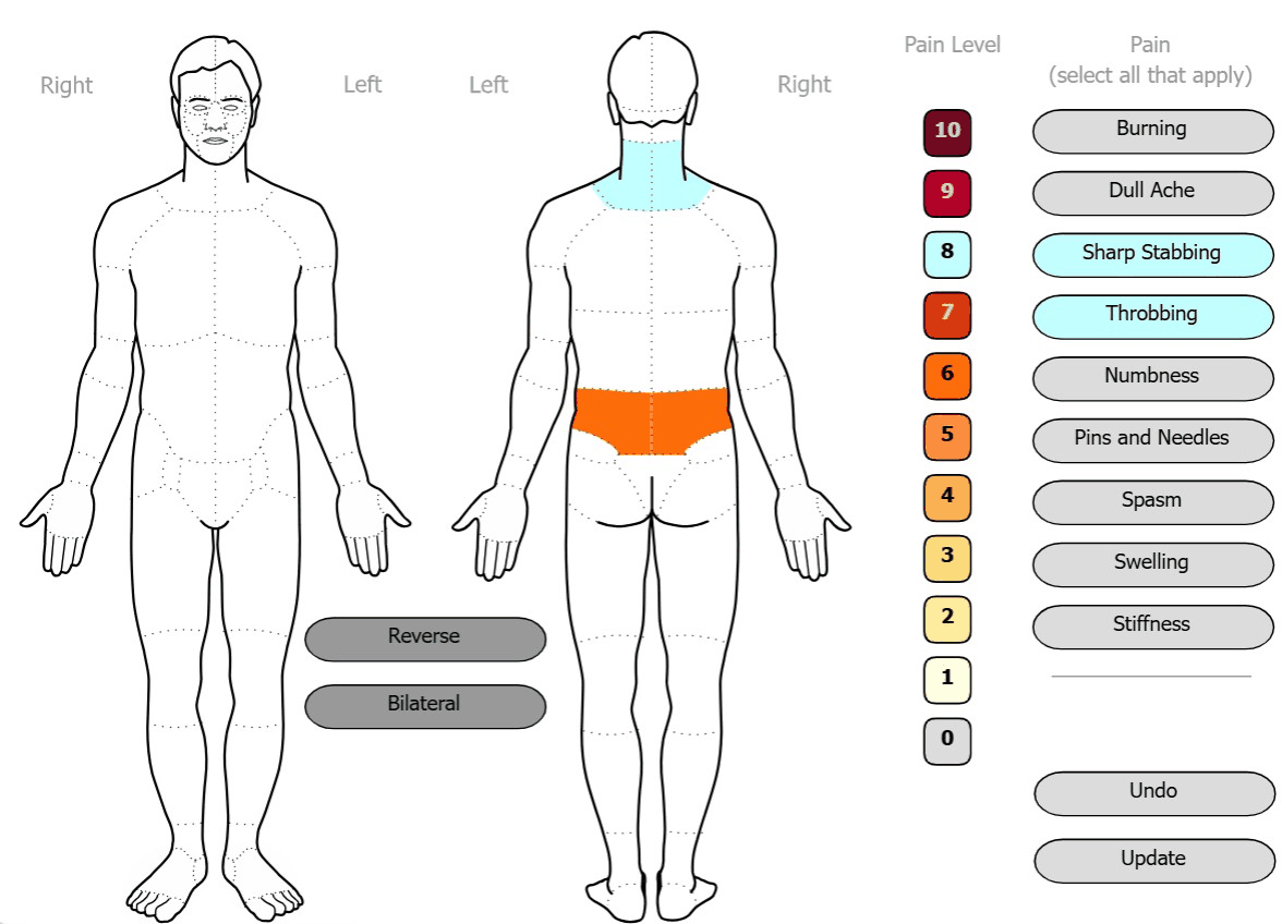 AuraChiro subjective pain map: front and back body diagrams with the neck marked for sharp stabbing pain and the low back marked at pain level 6, beside a 0–10 pain level scale and pain-type selectors